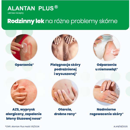Alantan Plus maść (20mg+50mg)/g 100 g