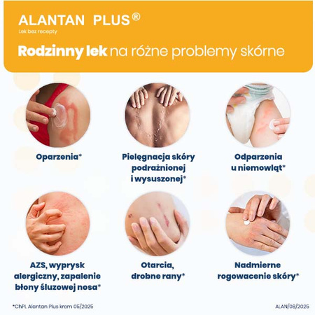 Alantan Plus krem (20mg+50mg)/g 100 g