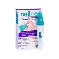 Nailner sztyft przeciw grzybiczy .