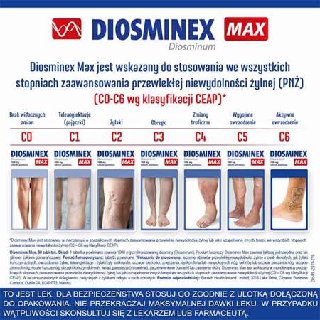 Diosminex Max 1000 mg, 30 tabletek powlekanych